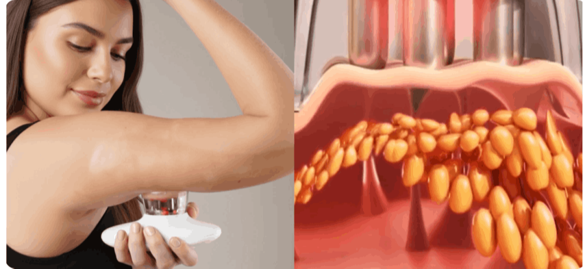 Glokore IPL Body Sculptor
